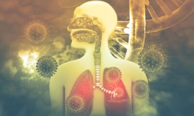 America Faces Unprecedented Rise in Cases of This Respiratory Illness